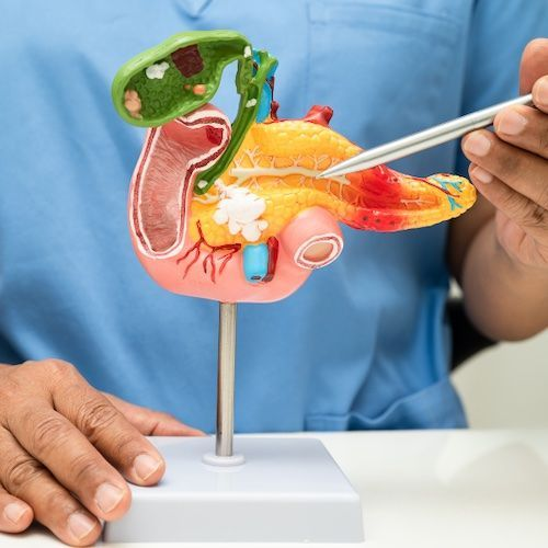 Gallbladder Stone Treatment