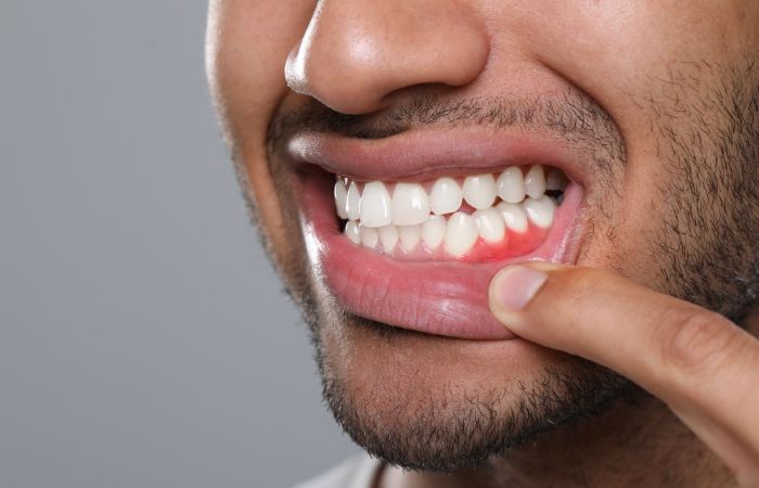 Daily Oral Care Routine Tips for Strong Teeth and Gums
