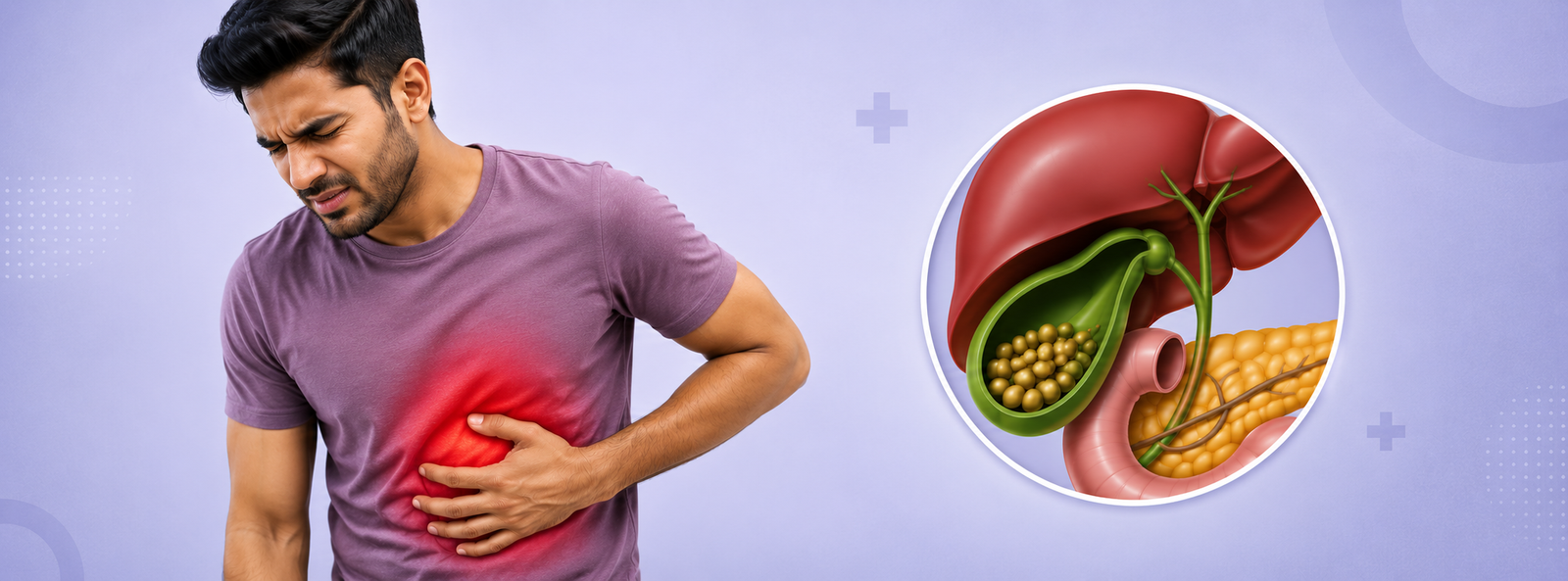 Best Gallbladder Stone Treatment in Patna