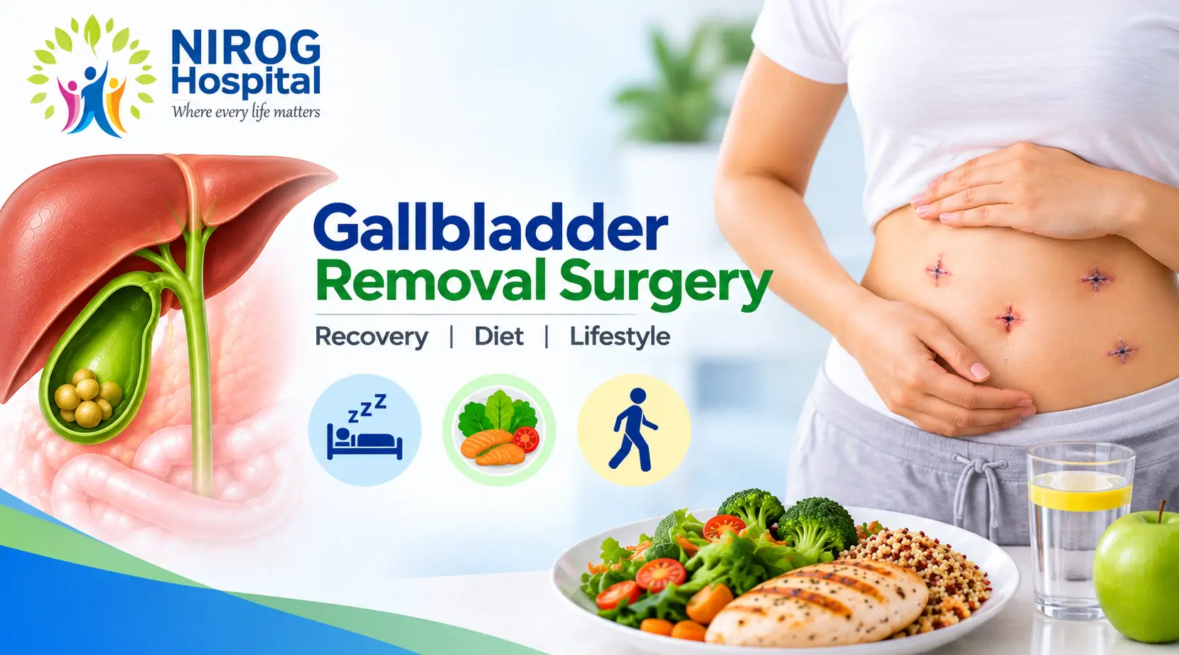 Gallbladder Removal Surgery: Recovery, Diet & Lifestyle After Surgery