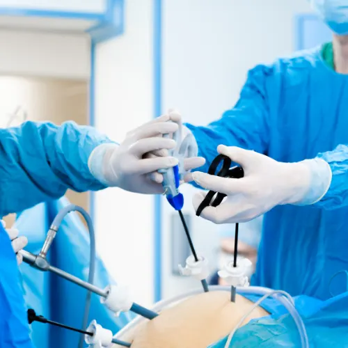 General & Laparoscopic Surgery